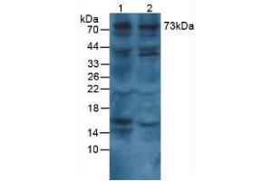 Figure. (COL8A1 anticorps  (AA 575-743))