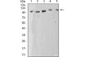 Western blot analysis using ATP2A1 mouse mAb against C2C12 (1), COS7 (2), Hela (3), K562 (4), and Jurkat (5) cell lysate.