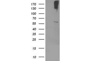 Western Blotting (WB) image for anti-Cytochrome P450, Family 2, Subfamily J, Polypeptide 2 (CYP2J2) antibody (ABIN1497732)