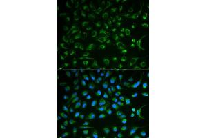 Immunofluorescence analysis of MCF7 cell using NT5E antibody. (CD73 anticorps  (AA 290-550))