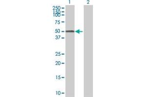 Lane 1: JUNB transfected lysate ( 38. (JUNB 293T Cell Transient Overexpression Lysate(Denatured))