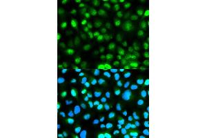 Immunofluorescence analysis of HeLa cell using ATXN3 antibody. (Ataxin 3 anticorps)