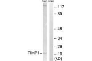 Western blot analysis of extracts from rat brain cells, using TIMP1 Antibody. (TIMP1 anticorps  (AA 61-110))