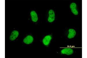 Immunofluorescence of monoclonal antibody to SMARCD2 on HeLa cell. (SMARCD2 anticorps  (AA 398-474))