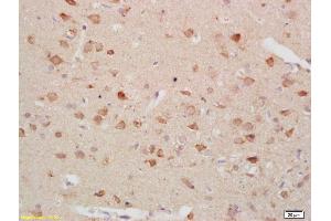 Formalin-fixed and paraffin embedded rat brain labeled with Anti-Gastrin receptor Polyclonal Antibody, Unconjugated (ABIN734318) at 1:200 followed by conjugation to the secondary antibody and DAB staining (CCKBR anticorps  (AA 301-400))