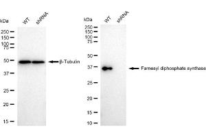 anti-Farnesyl Diphosphate Synthase (FDPS) antibody