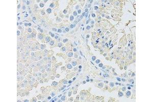 Immunohistochemistry of paraffin-embedded Mouse testis using SLC2A9 Polyclonal Antibody at dilution of 1:100 (40x lens).