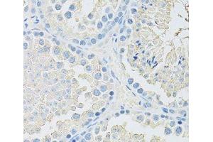 Immunohistochemistry of paraffin-embedded Mouse testis using SLC2A9 Polyclonal Antibody at dilution of 1:100 (40x lens). (SLC2A9 anticorps)