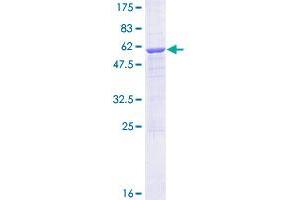 Image no. 1 for Methyltransferase Like 1 (METTL1) (AA 1-276) protein (GST tag) (ABIN1310745)