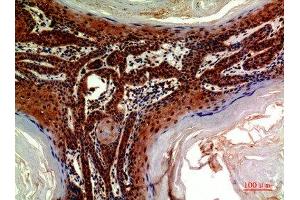 Immunohistochemical analysis of paraffin-embedded human-skin, antibody was diluted at 1:200 (ADAMTS18 anticorps  (AA 1030-1110))
