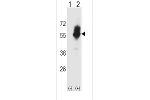 Western blot analysis of SLC7A1 using rabbit polyclonal SLC7A1 Antibody using 293 cell lysates (2 ug/lane) either nontransfected (Lane 1) or transiently transfected (Lane 2) with the SLC7A1 gene.