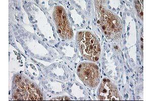 Immunohistochemical staining of paraffin-embedded Human Kidney tissue using anti-SOCS3 mouse monoclonal antibody. (SOCS3 anticorps)