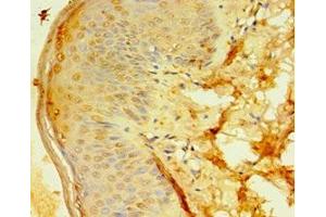 Immunohistochemistry of paraffin-embedded human skin tissue using ABIN7144984 at dilution of 1:100