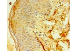 Immunohistochemistry of paraffin-embedded human skin tissue using ABIN7144984 at dilution of 1:100 (DDX39 anticorps  (AA 178-427))