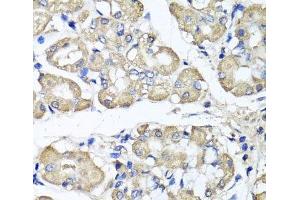 Immunohistochemistry of paraffin-embedded Human stomach using BCS1L Polyclonal Antibody at dilution of 1:100 (40x lens).