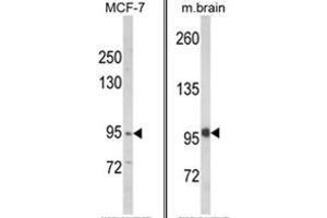 (LEFT) Western blot analysis of VPS53 Antibody (N-term) in MCF-7 cell line lysates (35ug/lane). (VPS53 anticorps  (N-Term))