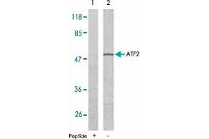 Western blot analysis of extract from LoVo cells using ATF2 polyclonal antibody  . (ATF2 anticorps)