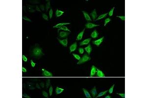 Immunofluorescence analysis of U2OS cells using NUTF2 Polyclonal Antibody (NUTF2 anticorps)