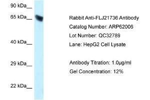 Western Blotting (WB) image for anti-Carboxylesterase 3 (CES3) (C-Term) antibody (ABIN2788984) (CES3 anticorps  (C-Term))