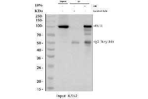 Immunoprecipitating (IP) HGS in K562 whole cell lysate.
