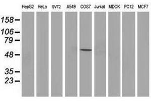 Image no. 3 for anti-Tumor Protein P53 (TP53) antibody (ABIN1499970)