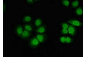 Immunofluorescent analysis of A549 cells using ABIN7148735 at dilution of 1:100 and Alexa Fluor 488-congugated AffiniPure Goat Anti-Rabbit IgG(H+L)