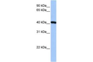 Western Blotting (WB) image for anti-FtsJ RNA Methyltransferase Homolog 1 (FTSJ1) antibody (ABIN2463265) (FTSJ1 anticorps)