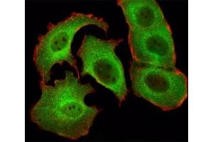 Immunohistochemical analysis of paraffin-embedded human skeletal muscle section using SMAD1 antibody