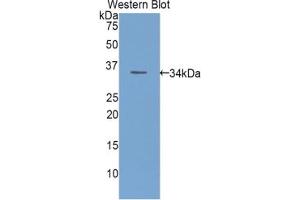 Western blot analysis of the recombinant protein. (ECE1 anticorps  (AA 326-577))