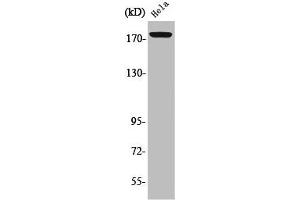 Western Blot analysis of HeLa cells using Phospho-Erbin (Y1104) Polyclonal Antibody (ERBB2IP anticorps  (pTyr1104))