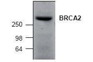 Image no. 1 for anti-Breast Cancer 2, Early Onset (BRCA2) (N-Term) antibody (ABIN127309)