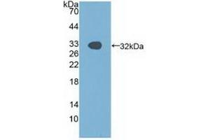 Western blot analysis of recombinant Human PAK1. (PAK1 anticorps  (AA 252-501))