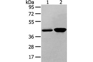 Western Blotting (WB) image for anti-Vasohibin 2 (VASH2) antibody (ABIN5958782) (Vasohibin 2 anticorps)
