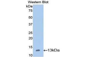 Western blot analysis of the recombinant protein. (Nephrin anticorps  (AA 39-144))