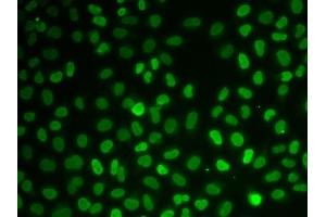 Immunofluorescence analysis of U2OS cells using Nono antibody. (NONO anticorps  (AA 1-300))