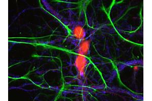 Immunocytochemistry (ICC) image for anti-Ubiquitin Carboxyl-terminal Esterase L1 (Ubiquitin Thiolesterase) (UCHL1) (AA 6-223) antibody (ABIN1742479)
