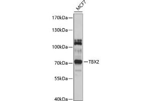 Western blot analysis of extracts of MCF-7 cells, using TBX2 antibody (ABIN6130916, ABIN6148906, ABIN6148907 and ABIN6214429) at 1:1000 dilution.