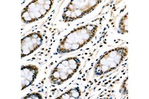 Immunohistochemistry of paraffin embedded human colon using Transketolase (ABIN7075978) at dilution of 1: 2200 (400x lens)