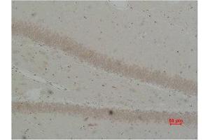 Immunohistochemistry (IHC) analysis of paraffin-embedded Rat Brain Tissue using BEST2 Polyclonal Antibody.