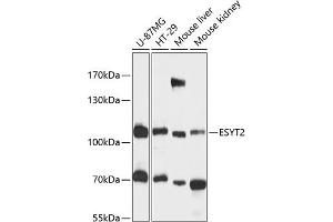 Western blot analysis of extracts of various cell lines, using ESYT2 antibody (ABIN6133009, ABIN6140463, ABIN6140464 and ABIN6216602) at 1:3000 dilution. (FAM62B anticorps  (AA 630-760))
