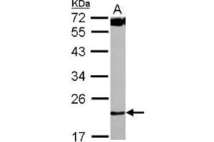 Western Blotting (WB) image for anti-Chromosome 4 Open Reading Frame 43 (C4orf43) (AA 1-192) antibody (ABIN1497058) (C4orf43 anticorps  (AA 1-192))