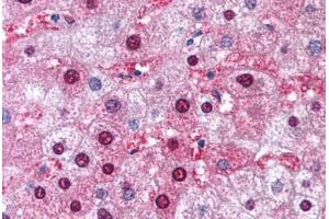 Human Liver (formalin-fixed, paraffin-embedded) stained with GSTM1 antibody ABIN214769 at 5 ug/ml followed by biotinylated goat anti-rabbit IgG secondary antibody ABIN481713, alkaline phosphatase-streptavidin and chromogen.