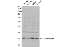 WB Image Aspartoacylase antibody detects Aspartoacylase protein by western blot analysis. (ASPA anticorps)