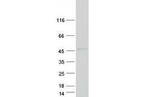 Validation with Western Blot