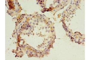 Immunohistochemistry of paraffin-embedded human testis tissue using ABIN7162659 at dilution of 1:100 (PARD3 anticorps  (AA 1068-1356))
