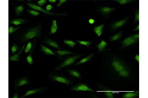 Immunofluorescence of monoclonal antibody to PRKCD on HeLa cell. (PKC delta anticorps  (AA 577-676))