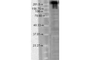 Nav1. (SCN9A anticorps  (AA 1751-1946))