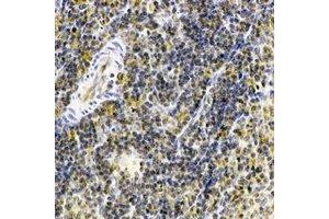 Immunohistochemical analysis of IL-23R staining in human spleen formalin fixed paraffin embedded tissue section.