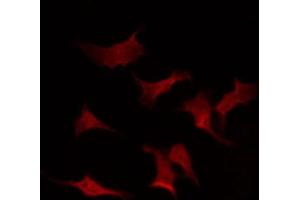 ABIN6267437 staining NIH-3T3 by IF/ICC.