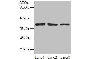 Western blot All lanes: ATP6AP2 antibody at 10 μg/mL Lane 1: Mouse eye tissue Lane 2: COLO205 whole cell lysate Lane 3: Hela whole cell lysate Secondary Goat polyclonal to rabbit IgG at 1/10000 dilution Predicted band size: 40, 36 kDa Observed band size: 40 kDa